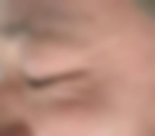 五、限时优惠——鼻部整形特别优惠价