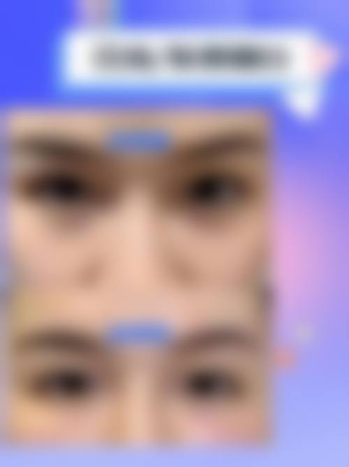 常见问题FAQ