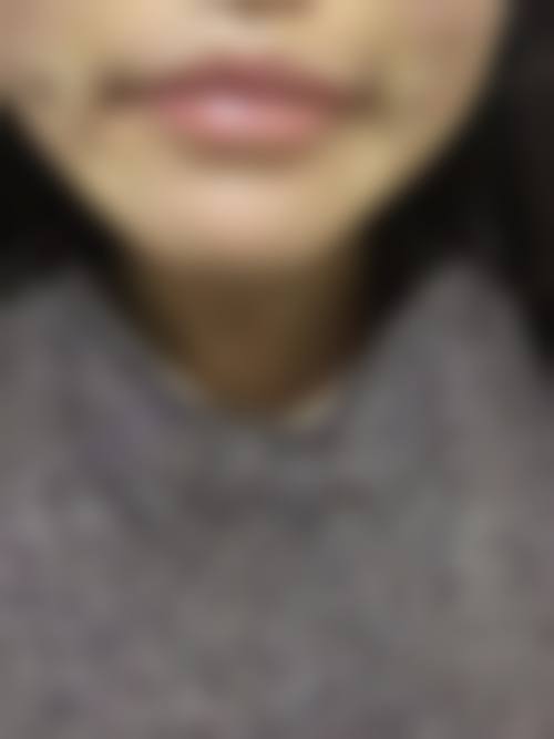 青岛妇婴医院整形美容中 心治疗反馈与口碑评价。