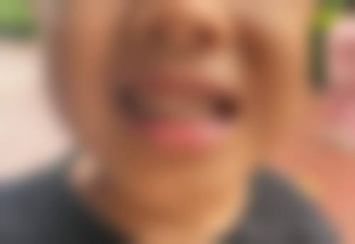 泰兴瑞赢口腔门诊部擅长项目。