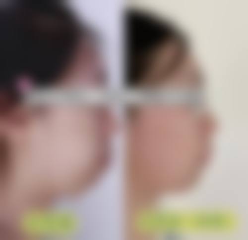 总结与预约号召