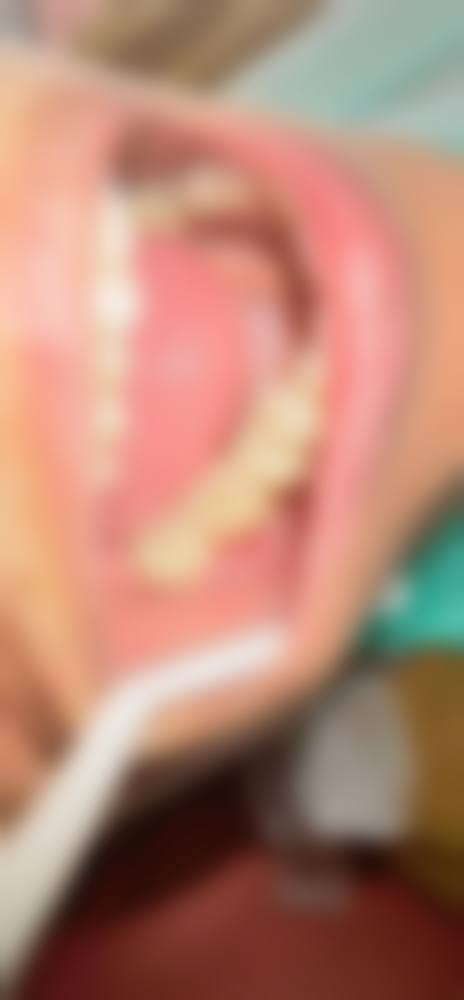 常见问题解答