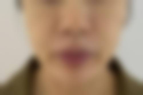 莫建明医生及医院项目价格说明