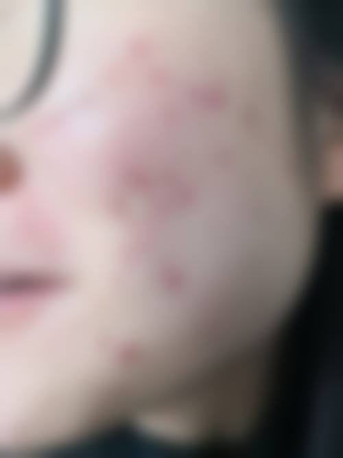 上海星时医疗美容门诊部医生团队经验稳定。