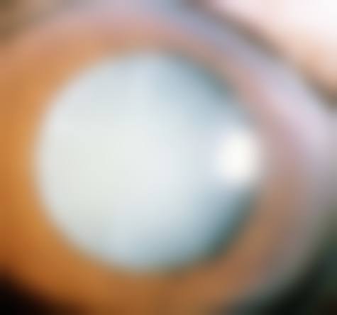 南方医 科附属瑞金医院眼科门诊营业时间。
