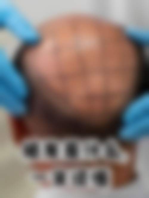 总结——北京西美医疗美容门诊部徐铢医生怎么样?