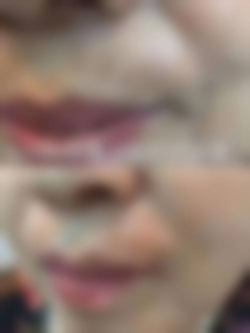 精良设备与无菌环境:科技护航,体验舒适