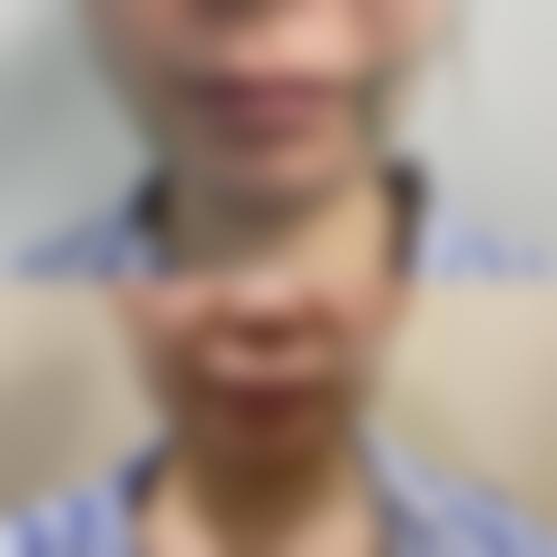 唐山联合丽珍医疗美容门诊部擅长项目。