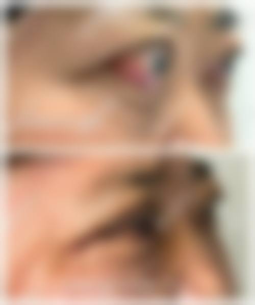 南方医 科附属瑞金医院眼科擅长项目。