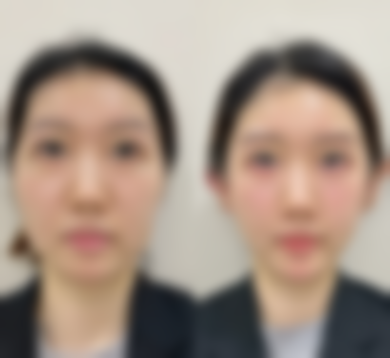 韩国客丽达整形外科收费标准参考