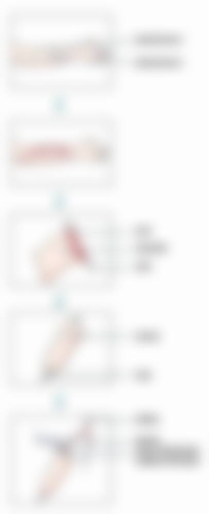 服务流程与预约方式:从询问到术后全程贴心陪伴