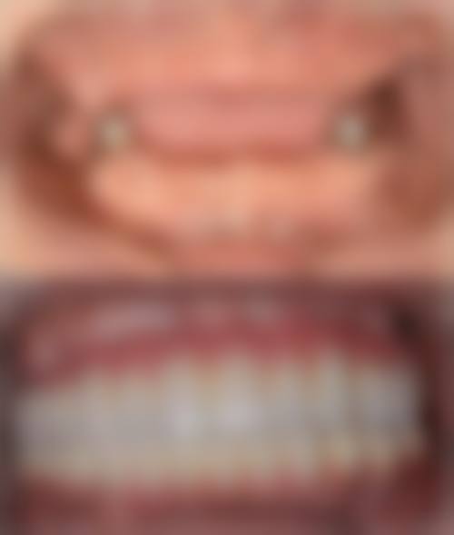 医院资质与实力：正规口腔机构的具有影响力保护