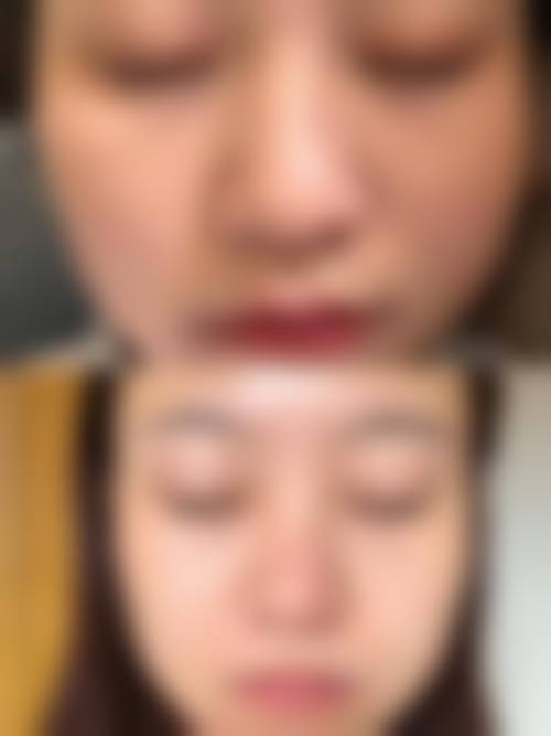 设备环境与安心标准:层流手术室与无菌保护