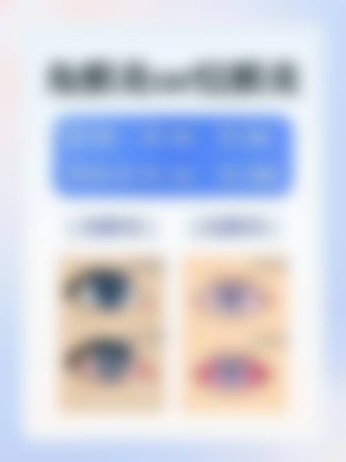 哈尔滨市阿城区人民医院眼科医生团队经验稳定。