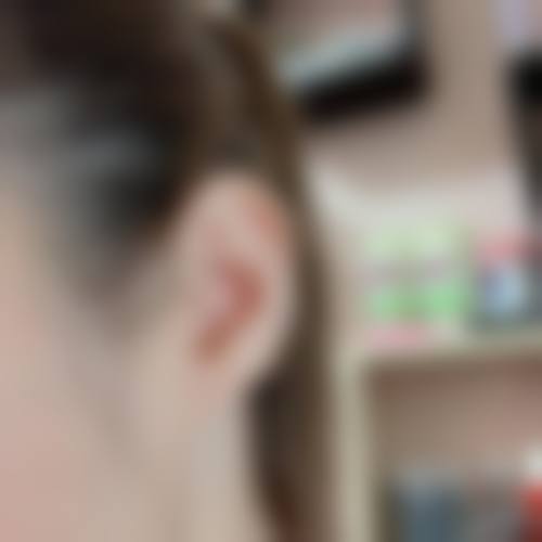 优惠活动详情:限时补贴助力美丽计划