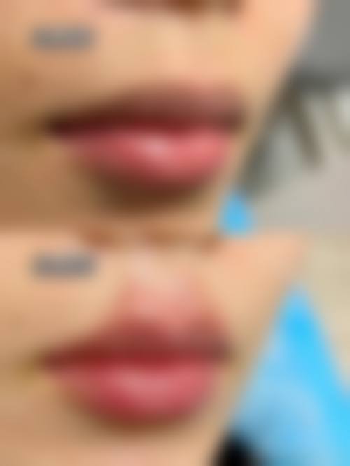 擅长项目详解