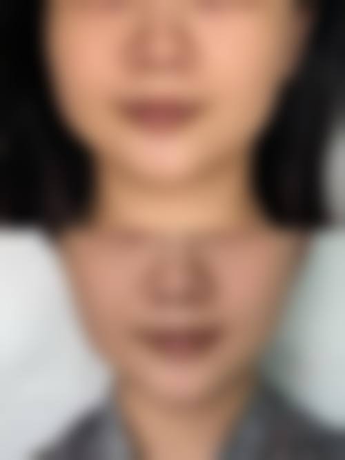 丽迪安治疗反馈与口碑评价