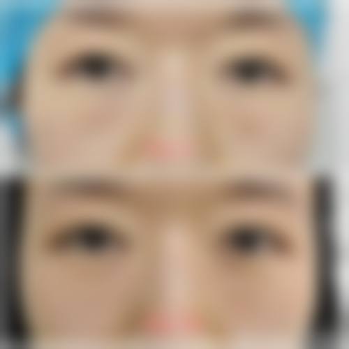 服务流程:从询问到术后全程贴心
