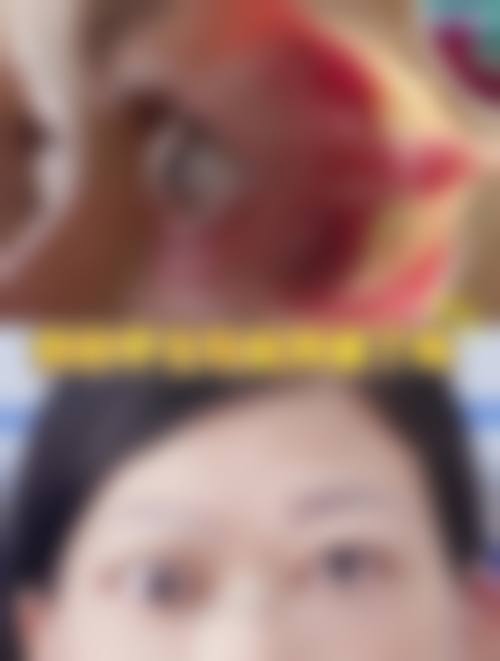 上海润美眼科门诊部预约挂号方式。