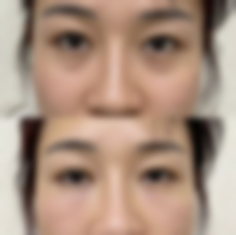 四川悦好医学美容医院向俊妮医生挂号预约攻略