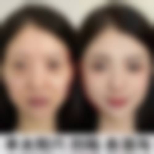 佛山市第五人民医院整形美容科治疗反馈与口碑评价。