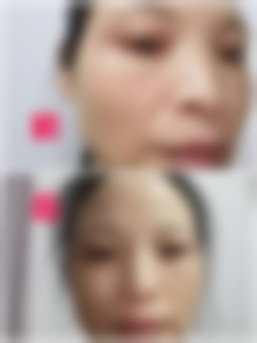 莎车梵熙整形医院擅长项目。