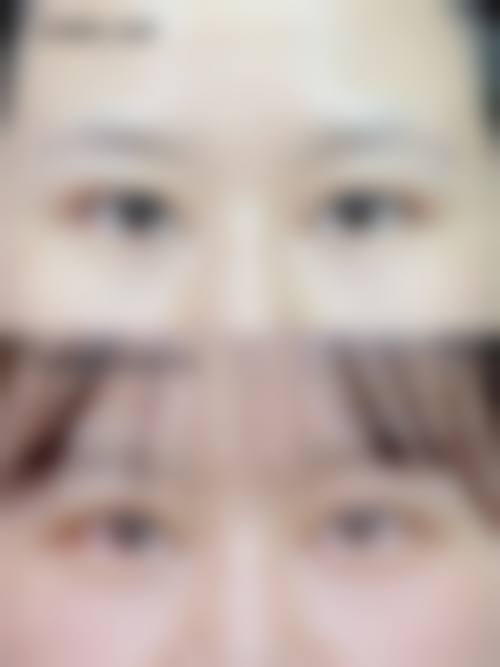 南京全美医疗美容诊所治疗反馈与口碑评价