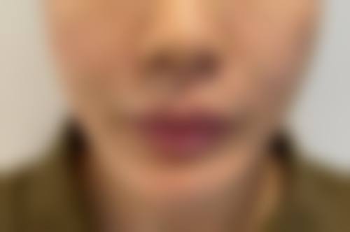 成都医学校第一附属医院美容整形烧伤外科预约方式