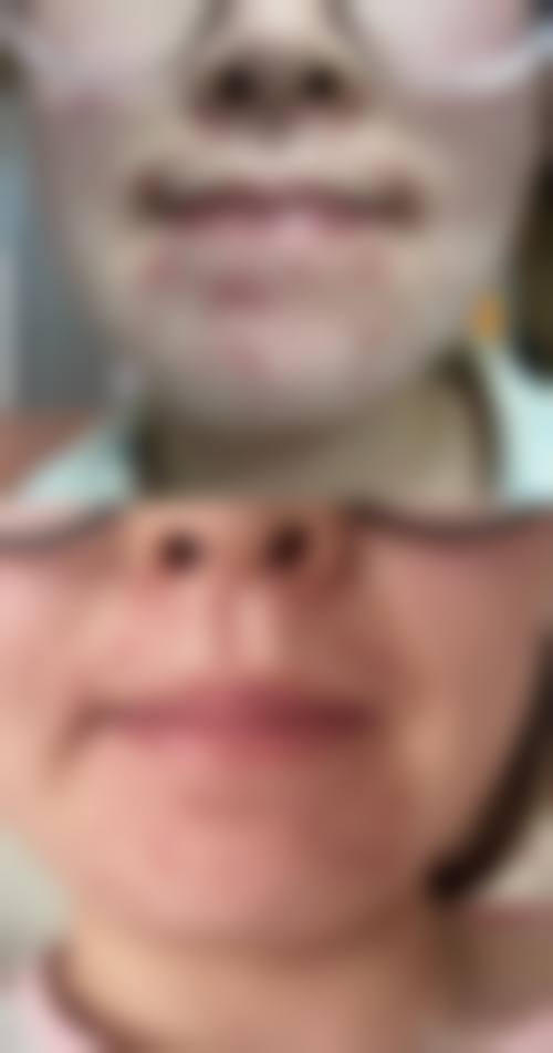 特色医美项目与优势:法式轻医美,自然蜕变