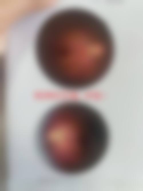 临沂市妇幼保健院眼科地理位置便于到院