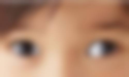 特色项目与技术:专注眼部整形,辐射全方面医美