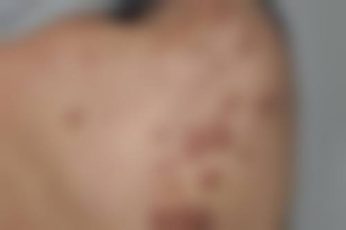 优惠活动详情:到院即享,透明收费