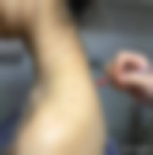 患者真实评价