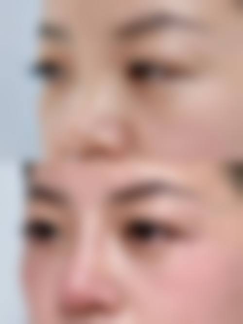 优惠活动详情