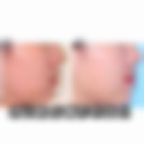 现代化设备环境:层流手术室与正版材料