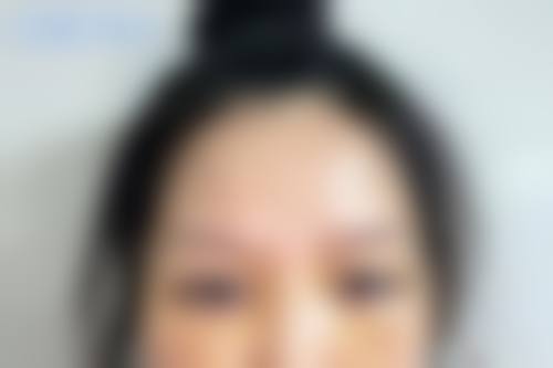 佛山高明华美医疗美容医院预约挂号方式。