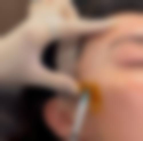 临床实例分享