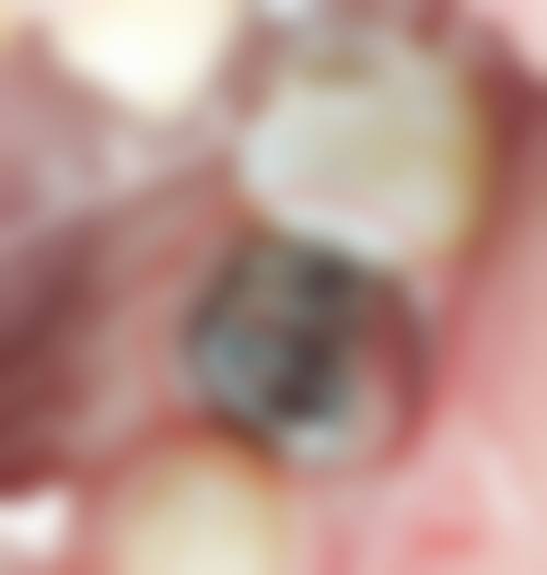 总结与预约号召