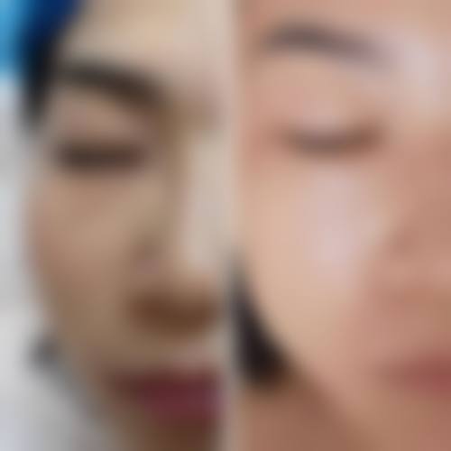 擅长项目详解:梁利荣