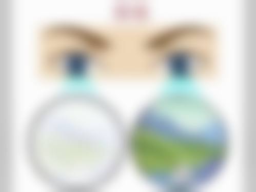 资阳光正新视界眼科医院治疗反馈与口碑评价。