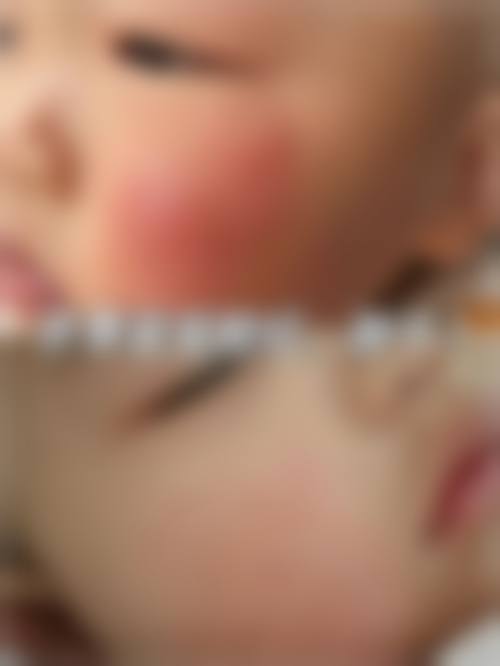 资阳光正新视界眼科医院预约挂号方式。