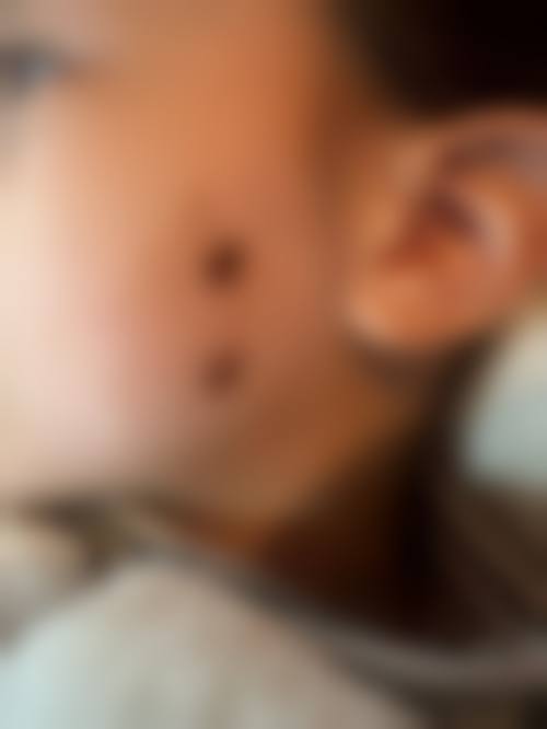 诊疗特色总结:梁利荣