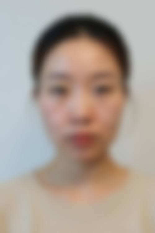 预约优惠活动:梁利荣