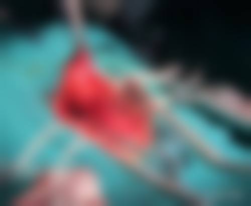 服务流程与透明定价:让美无需顾虑