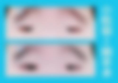 长春中 医 药大学附属医院眼科项目价格询问。