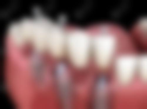 常见问题解答 (FAQ)