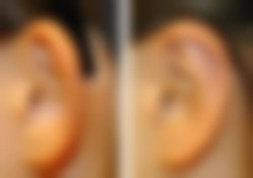总结:为何选择韩国美迪莹整形外科?