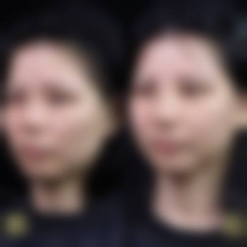 个性化就诊流程:从预约到术后管理