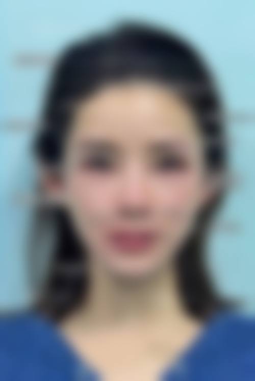 特色科室与项目:个性化方案解决腋臭顽疾