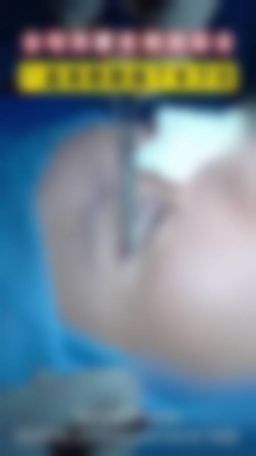 擅长项目详解